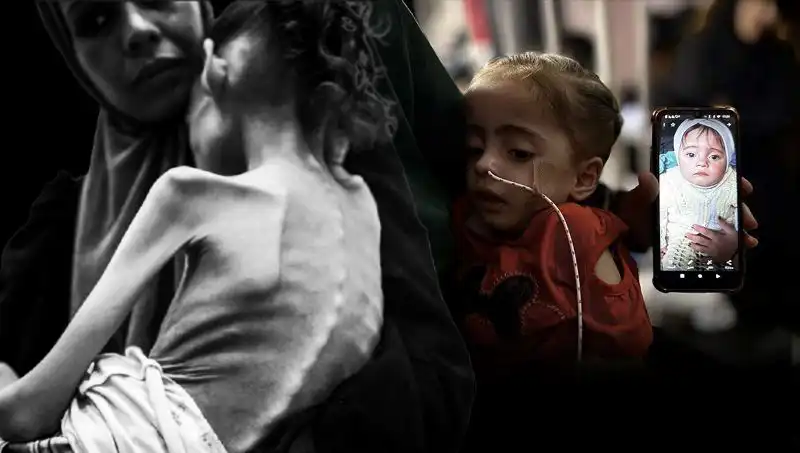 Küçük Meryem’in Açlık Mücadelesi: 25 Kilodan 10 Kiloya Düştü!