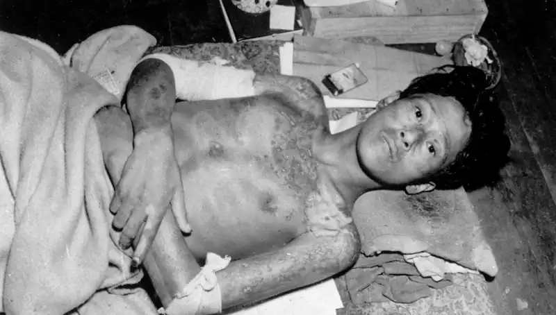 80 Yıl Sonra Nagasaki’den Dünya’ya Uyarı: Nükleer Tehdit Büyüyor