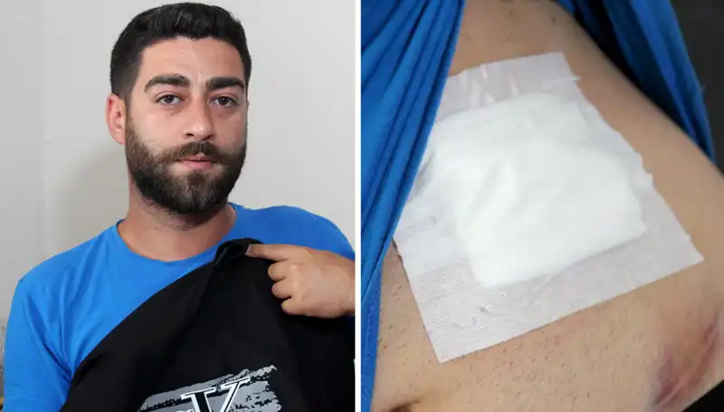 Karnındaki Ağrı Nedenini Röntgenle Öğrenen Kadının Hikayesi